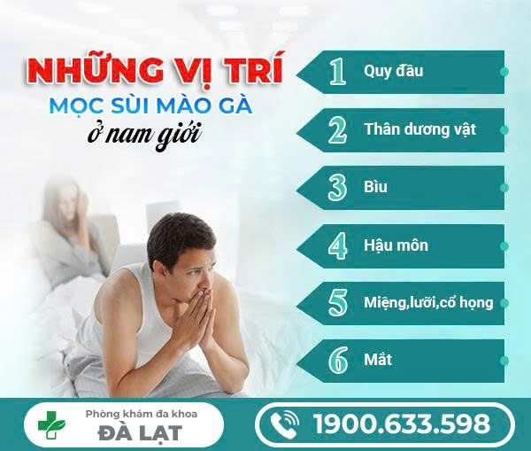 Hình ảnh minh họa